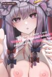 [Alba] The story of how I was raped by Patchouli when I confessed my feelings to her
